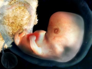 fetus at 5 weeks
